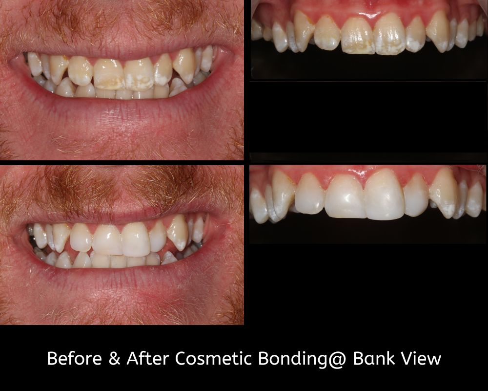 Bank View - Helping Our Patients Smile Again