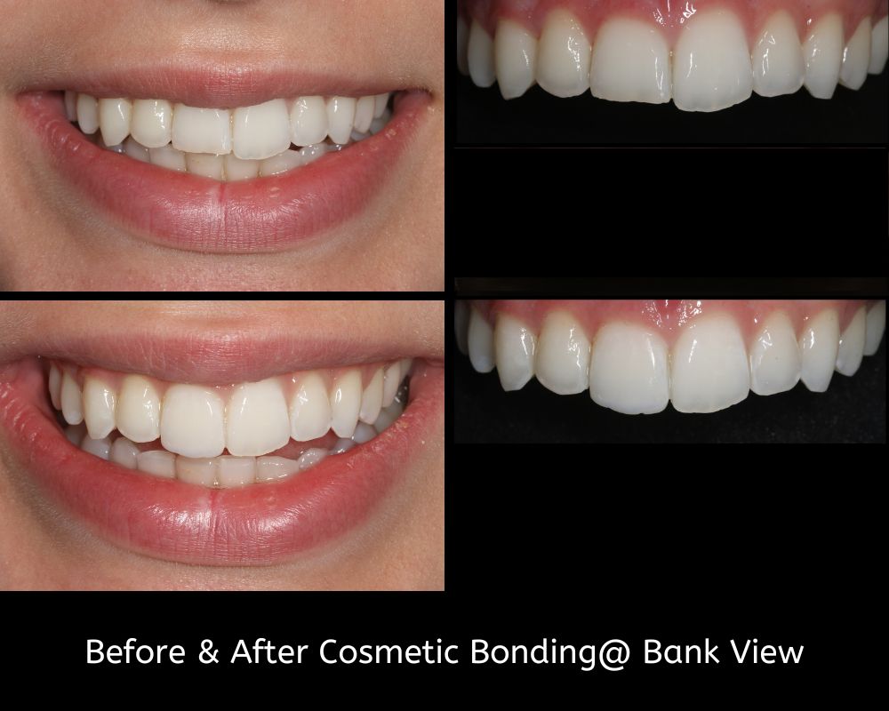 Bank View - Helping Our Patients Smile Again
